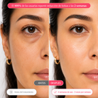 NuvaSkin - Parches oculares de colágeno para ojeras y bolsas