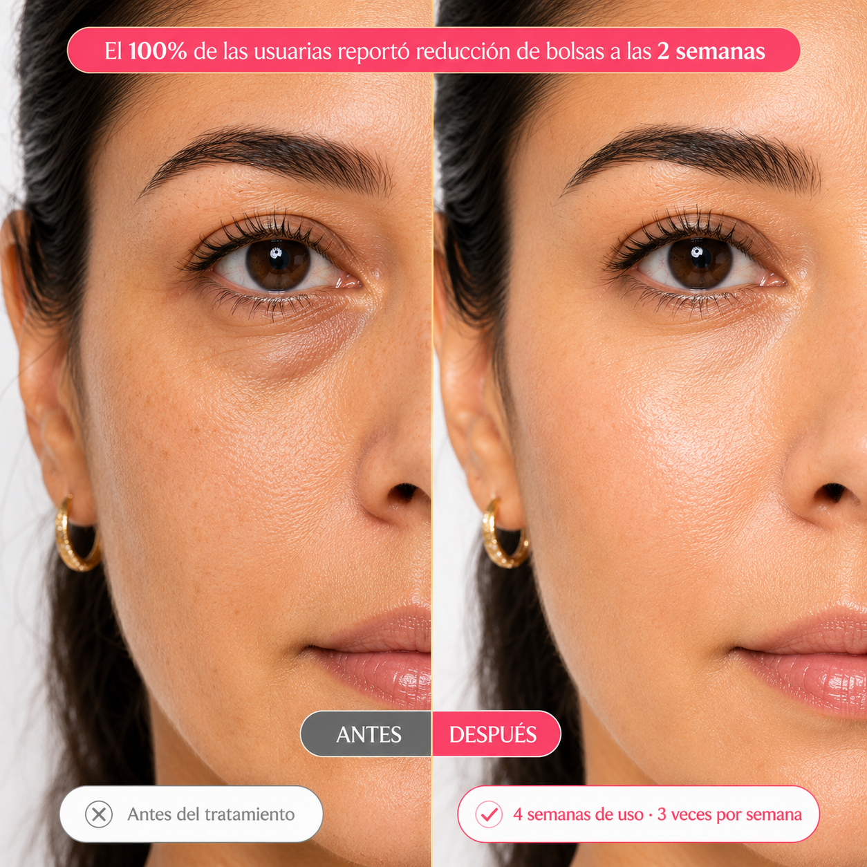 NuvaSkin - Parches oculares de colágeno para ojeras y bolsas